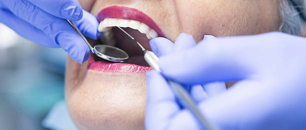 Best Emergency Treatment for Toothache in Columbia City, IN