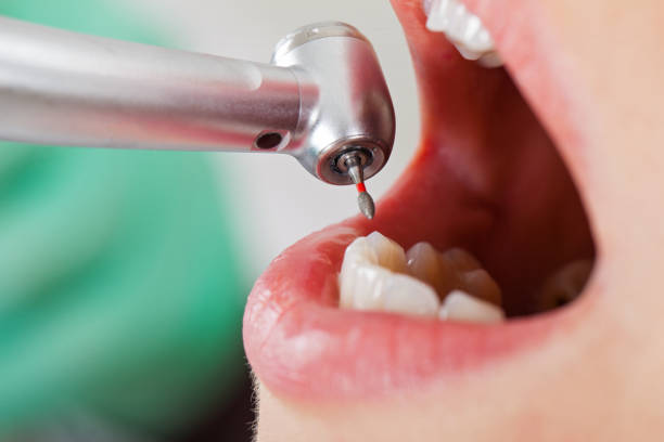 Best Emergency Dental Care for Trauma or Injury in Columbia City, IN